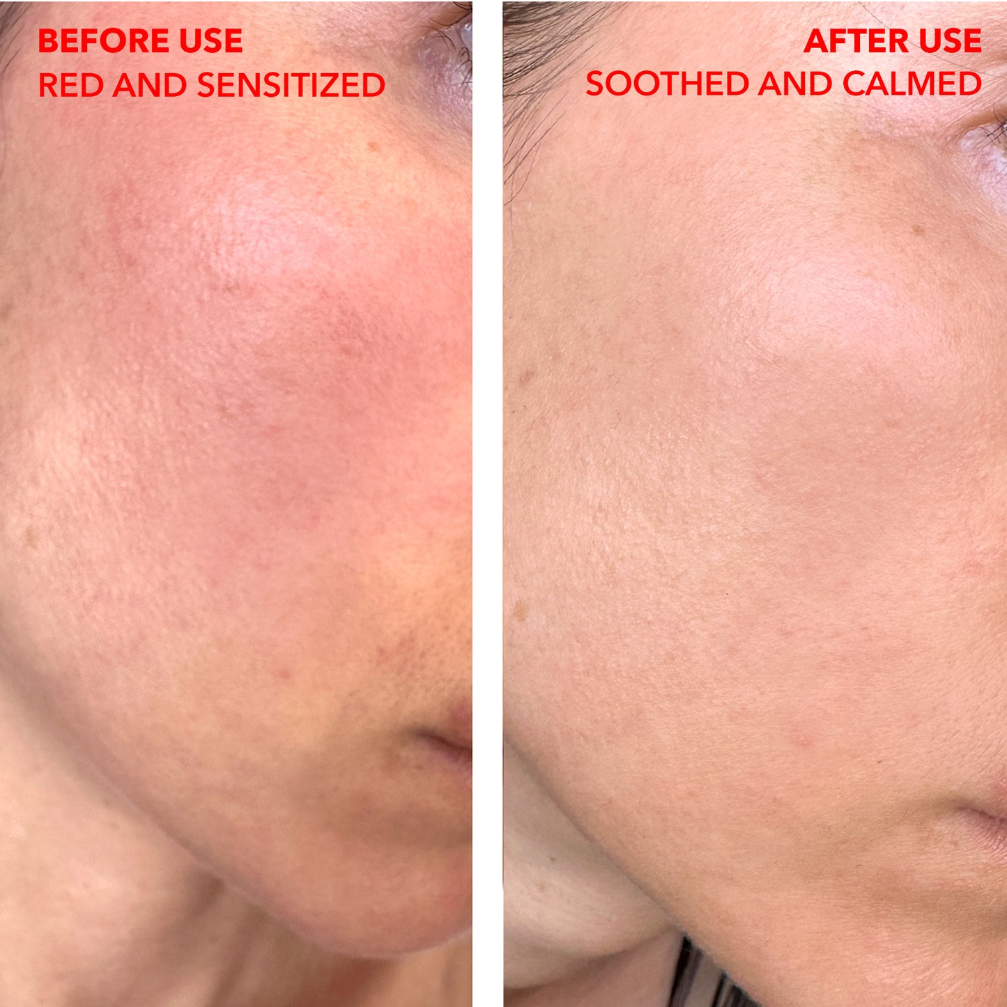 Anti-Redness Drops