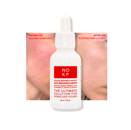 Anti-Redness Drops